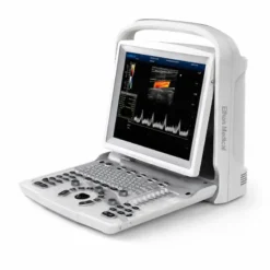 CHISON ECO 3 Expert portable ultrasound machine in Bangladesh – Ethan Medical