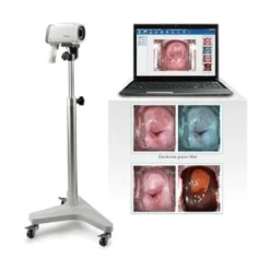 EDAN C6A HD Video Colposcope in Bangladesh at Ethan Medical Ins.