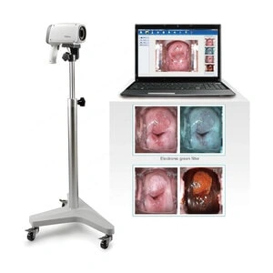 EDAN C6A HD Video Colposcope in Bangladesh at Ethan Medical Ins.